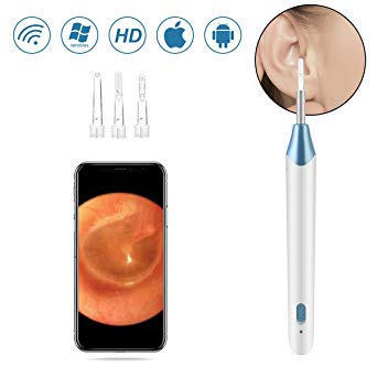 Wireless Ear Endoscope, WiFi Ear Scope with Light,Otoscope,Ear Wax Removal Tool Ear Cleaning Kit,720P Ear Camera for iPhone Android iPad Window MAC with Ear Pick Spoon by SOONHUA