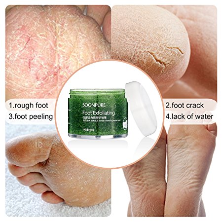 Foot Exfoliating Scrub Gel, Foot Whitening Skin Care, Foot Moisturizer, Foot Callus Remover- Softens for Thick Cracked Rough Dead Dry Heel Feet with Natural Phytoextraction Particles, 5.07 Fl.Oz.