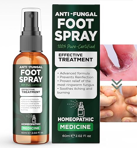 Anti-Fungal Foot Spray | Athletes Foot Spray, Foot Odor Spray, Ringworm Treatment | Anti Itch Foot Fungus Spray| Extra Strength Formula Fast Relief, Long-Lasting Protection |for Itchy & Irritated Skin