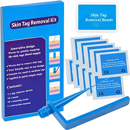 Blue Micro Skin Tag Remover Device Kit for Small to Medium Skin Tags
