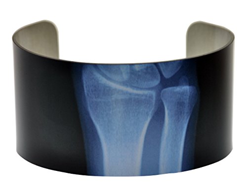 X-Ray of Wrist Aluminium Cuff