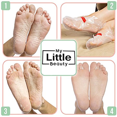 MY LITTLE BEAUTY Foot Peel Mask - Exfoliating Callus Remover for Touch Smooth Feet (2 Pairs Per Box)
