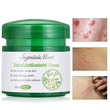 SEGMINISMART Natural Herbal Cream, Psoriasis Cream, Cream for Eczema and Dermatitis, Treatment For Itchy, Cracked and Irritated Skin Itch Relief Cream