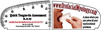 Quick Tongue Tie assessment