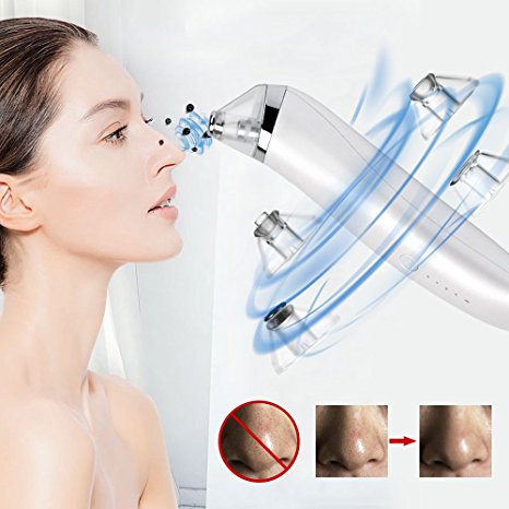 Electric Blackhead Remover Pore Vacuum Acne Blackhead Suction Removal with 4 Multi-function Probe for Microdermabrasion MEFA