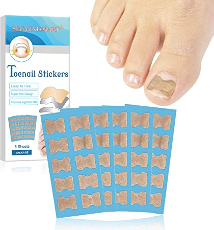 Ingrown Toenail Correction Patch, Toenail Correction Patch, Ingrown Toenail Stick Patch, Glue Free Toenail Patch, Toe Nail Patches, Nail Correction Stickers, for Men Women Toenail Care Tool, 50Pcs