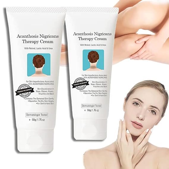 Nigrifree Dark Spot Corrector Cream, Nigrifree Acanthosis Nigricans T-herapy Cream,Dark Spot Removal Cream, For Face & Body Dark Spot Removal Serum (2 Count)