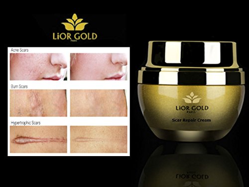 Lior Gold Paris Scar Repair Cream