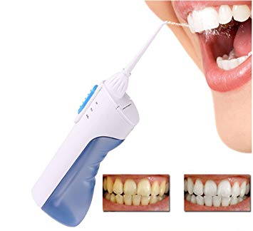 N Noble One Cordless Electric Dental Flosser - Portable Water Floss with Rotatable Jet Pick Travel Teeth Cleaner Kit Power by Battery