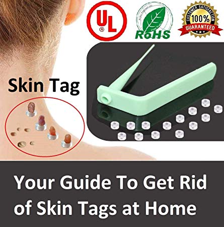 Skin Tag Remover Device - for Small to Medium Skin Tags