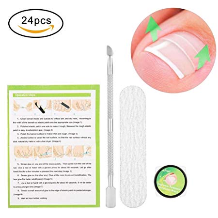 Professional Ingrown Pincer Toenail Correction Sticker Pedicure Paronychia Recover Foot CareTool with Nail File and Cuticle Pusher(24Pcs Patches)