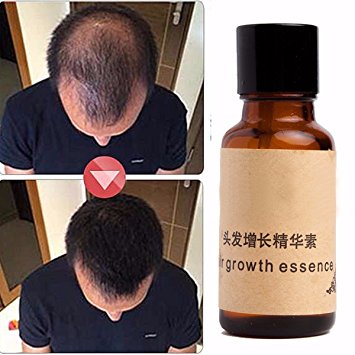 Skymore Hair Regrowth Treatment Product,Hair Growth Essence oil,Hair Loss Therapy,Anti Gray Hair Liquid