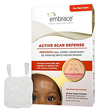 Embrace Active Scar Defense  Silicone Scar Sheets For New Scar Treatment, Small (1.6"), 3 ct., 30 Day Supply