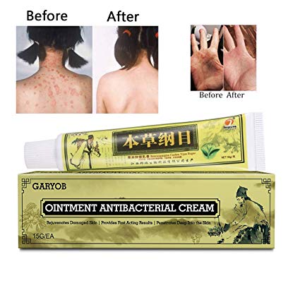 GARYOB Antibacterial Cream Natural Gentle Repair Psoriasis Eczema Dry Itching, Chinese Herbal Cream for Skin Disease Treatment