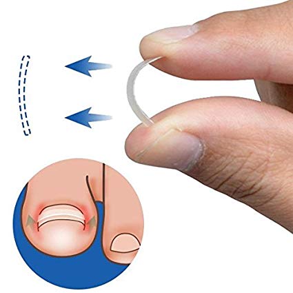 Ingrown Toenail Straightening Clip Curved Brace Toenails Thick Correction Tool