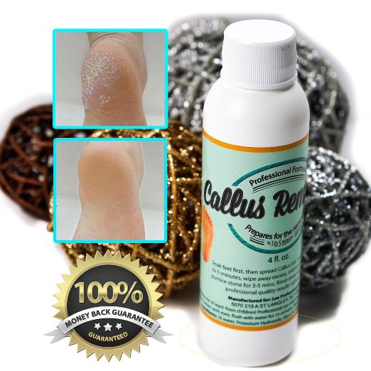 Callus Eliminator - Callus Remover Gel/lotion/cream for Foot and Hands. Does Better Job Than Electric,shaver, and Other Scary Tools.