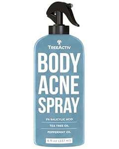 TreeActiv Body & Back Acne Treatment Original Formula, 8 fl oz, 2% Salicylic Acid Spray, Cystic Acne Treatment, Body Acne Spray, Chest, Shoulders & More, Bacne Spray for Teens & Adults