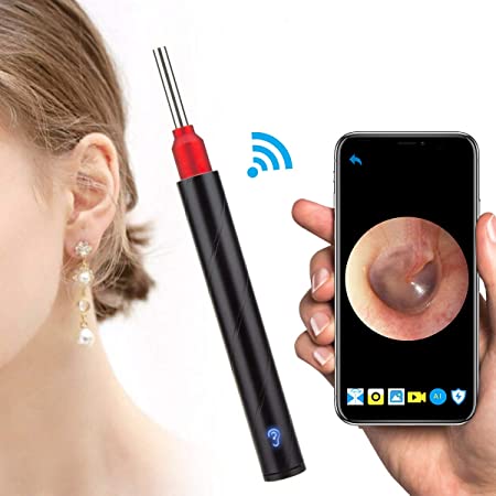 Earwax Removal Tool,Wireless Otoscope Ear Wax Removal Kit 1080P HD WiFi Ear Endoscope with LED Lights,3.5mm Visual Ear Camera Portable Ear Pick Cleaning Kit for Adults Kids & Pets Black