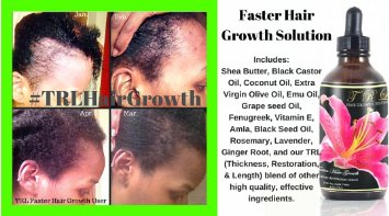 TRL Faster Hair Growth Oil