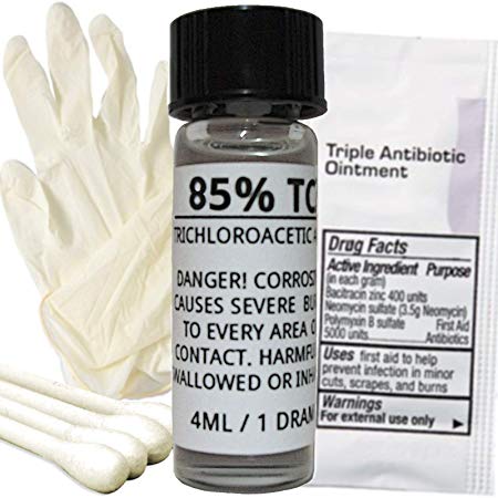 85% TCA Home Skin Peel Kit - Remove Age Spots, Tattoos, Scars, Stretch Marks, Acne Scars, Moles, Skin Tags, Hyperpigmentation, Wrinkles and Freckles!