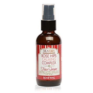 Shea Terra Organics Rose Hips Calming Complex Face Serum | Anti-Irritation Facial Treatment, Anti-Aging Drops, All Natural Home Spa Products and Beauty Salon Supplies – 2 oz
