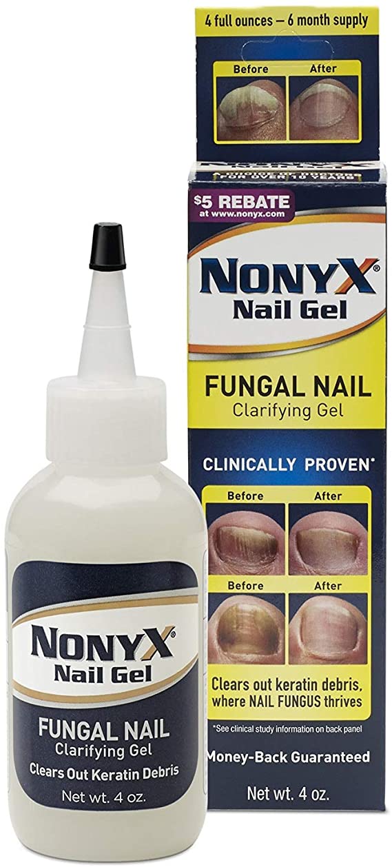 NONYX FUNGAL Nail CLARIFYING Gel, Clears Out Unsightly Keratin Debris Where Nail Fungus Grows, Effective for Damaged, Discolored, Thick, Yellow Toenails & Fingernails. Results in Healthy-Looking Nails