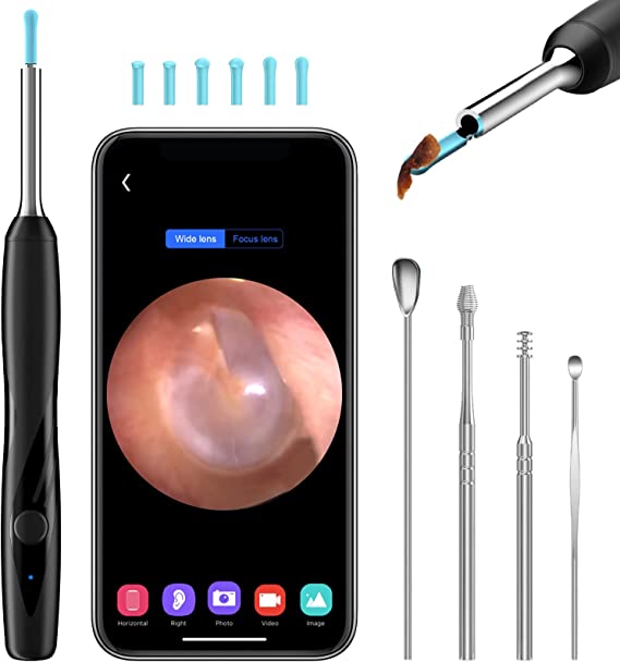 CHOOBY Ear Wax Removal Tool Camera, Ear Cleaner Kit with Camera, Earwax Remover Wireless Otoscope, 1080 FHD WiFi Ear Camera with 10 Pcs Ear Scoop for i-Phone & i-Pad & Android Smart Phones