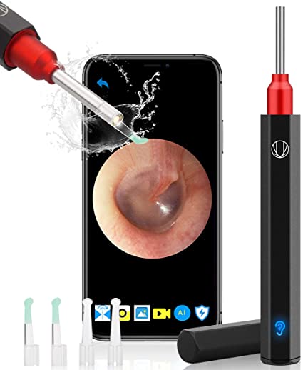 SFABF Ear Wax Removal,1080P Digital Ear Endoscope Earwax Removal Tool Wireless Otoscope Ear Camera and Wax Remover Kit with Replacable Ear Spoons IP67 Waterproof Ear Cleaner with LED Lights Black