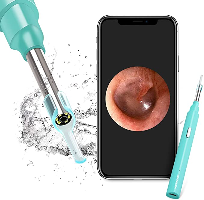 Ear Wax Removal Endoscope, Earwax Remover Tool,1080P FHD Wireless Ear Otoscope with LED Lights, Ear Camera,Ear Scope with Ear Wax Cleaner Tool for iPhone, iPad & Android Smart Phones(Green)