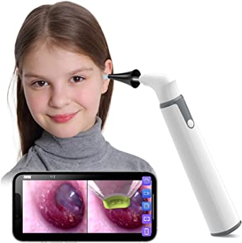 Ear Wax Removal Kit Ear Camera with Dual View, ScopeAround 3.9mm Wireless Ear Otoscope with 6 LED Lights, Earwax Cleaner for Kids, Adults & Pets, Compatible with Android/iPhone/iPad (White)