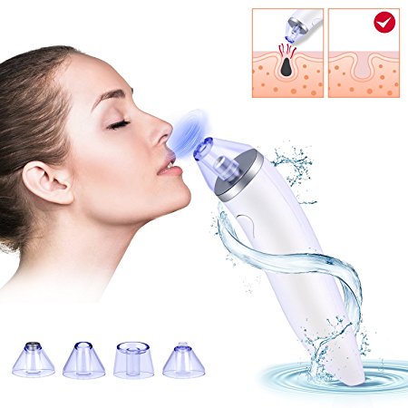 Blackhead Remover, USB Rechargeable Comedo Vacuum Suction Electric Facial Pore Cleanser Exfoliating Acne Extractor Skin Firming Machine With 4 Heads (White)