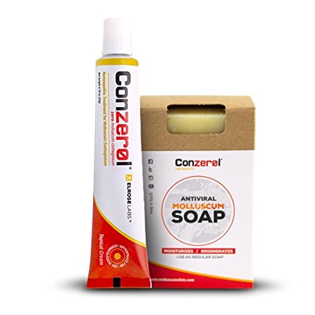 Stop Molluscum Today. Conzerol 2 Step Treatment for Molluscum Contagiosum. Painfree and Natural
