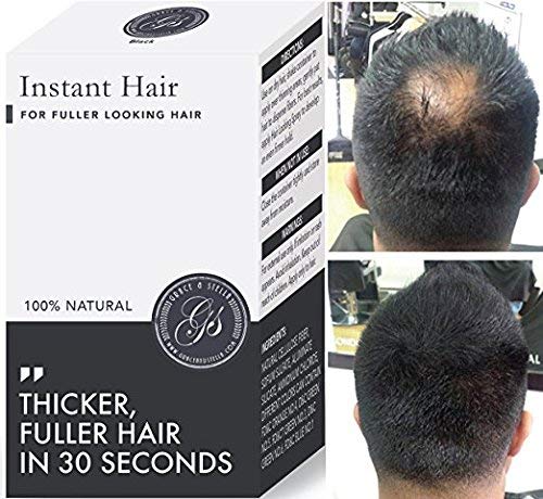 Instant Hair Building Fibers - 100% Keratin Fibres Cover Thinning and Balding Spots, Make Hair Thicker! Hair Loss Treatment for Men & Women (5 Week Supply, Light Brown) **As seen on Dragons Den**