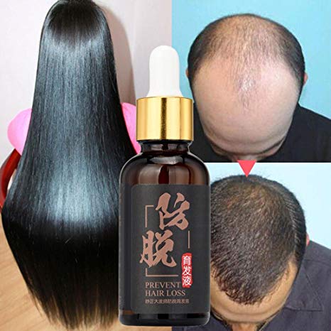 Fheaven (TM) Natural Hair Growth Essence liquid Fast Hair Growth Hair Loss Treatment for Hair Thinning and Loss