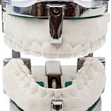 JampS Dental Lab Custom Night Guard for Teeth Grinding Bruxism TMJ - Bite Guard Mouth Guard - Upper
