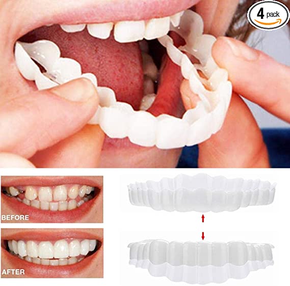 Snap On Smile - Instant Perfect Smile Clip On Veneers (Work for Top Or Bottom) - Perfect Braces and Whitening Alternative No Pain No Shots No Drilling - Perfect Smile in Minutes
