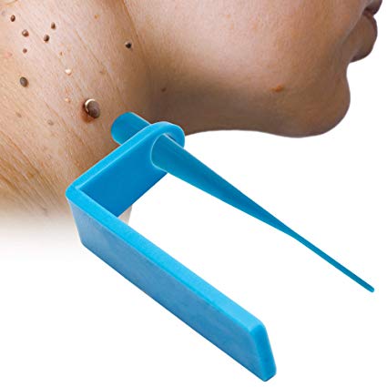 Vassoul Skin Tag Remover, Skin Tag Treatment Kit For Home Use