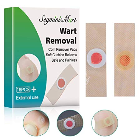 Wart Removal,Corn Callus Remover,Plantar Wart Remover, Foot Wart Remover, Common and Plantar Warts Treatment