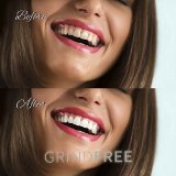 Teeth Whitening Gel with Tray - Instantly Whiter Brighter Teeth - Best Whitener Available - Makes Every Tooth as White as Possible