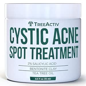 TreeActiv Salicylic Acid Cystic Acne Spot Treatment, 0.5 fl oz, Acne Treatment for Face, Acne Spot Cream, Hormonal Acne Treatment, Acne Spot Treatment for Face and Body, Acne Cream for Teens & Adults