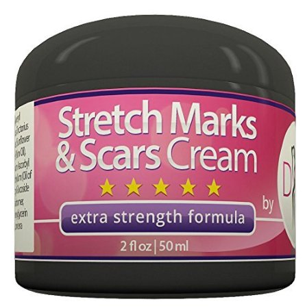 Diva Fit & Sexy Stretch Mark and Scar Removal Cream, 2 fl. oz.
