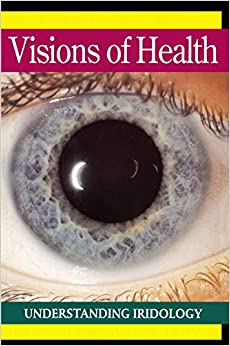 Visions of Health : Understanding Iridology