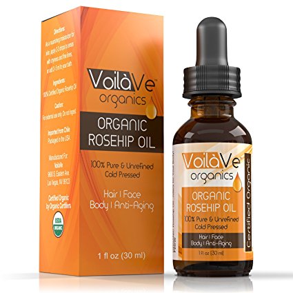 Organic Rosehip Oil - Cold-pressed 100% Pure USDA Certified Organic – Beauty Oil for Skin, Hair, and Nails – Treats Dermatitis, Psoriasis, Eczema, Scars, and Stretch Marks – 1 Fl. Oz.