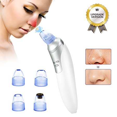 Mckbane Electric Blackhead Remover (Newest Version) Portable Facial Pore Acne Cleanser Comedo Suction Device Skin Care Tool Set of White with 4 Heads USB Rechargeable for Women Men (White)