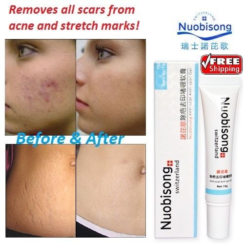 Nuobisong Face Care Acne Treatment Scar Stretch Marks Removal Whitening Cream
