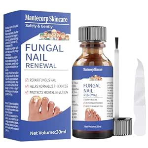 Toenail Fungus Treatment - Toenail Fungus Treatment Extra Strength, Toe Nail Fungus Treatments, Nail Fungus Treatment For Toenail, Nail Repair Solution - Safely and Gently