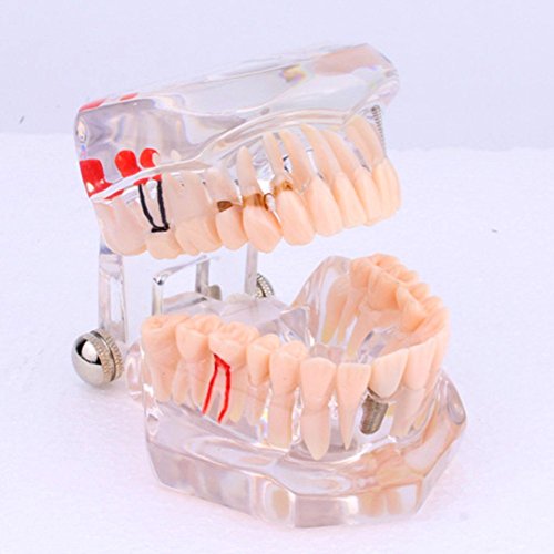 Yosoo Dental Study Teaching Teeth Model Adult Typodont Model Removable Tooth