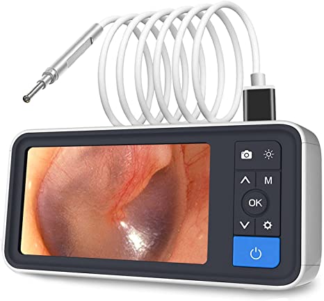 Otoscope with Light, Petrichor 4.5'' IPS Digital Video Otoscope, 3.9mm Ear Camera with 6 Dimmable LED, Ear Wax Removal Camera with 32GB Card, Rechargeable Ear Video Camera