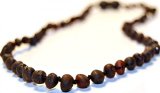 Certified Baltic Amber Teething Necklace for Baby Raw black cherry - Anti-inflammatory