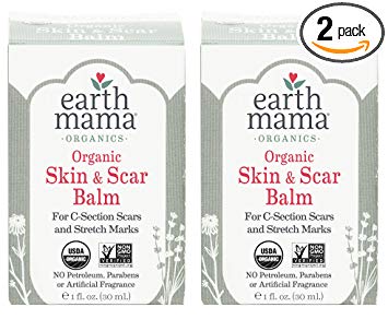 Earth Mama Organic Skin & Scar Balm for C-Section Scars and Stretch Marks, 1-Fluid Ounce (2-Pack)